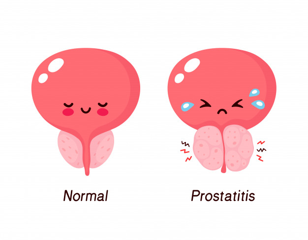 Prostatitis és allergia pleomorphic adenoma pet ct